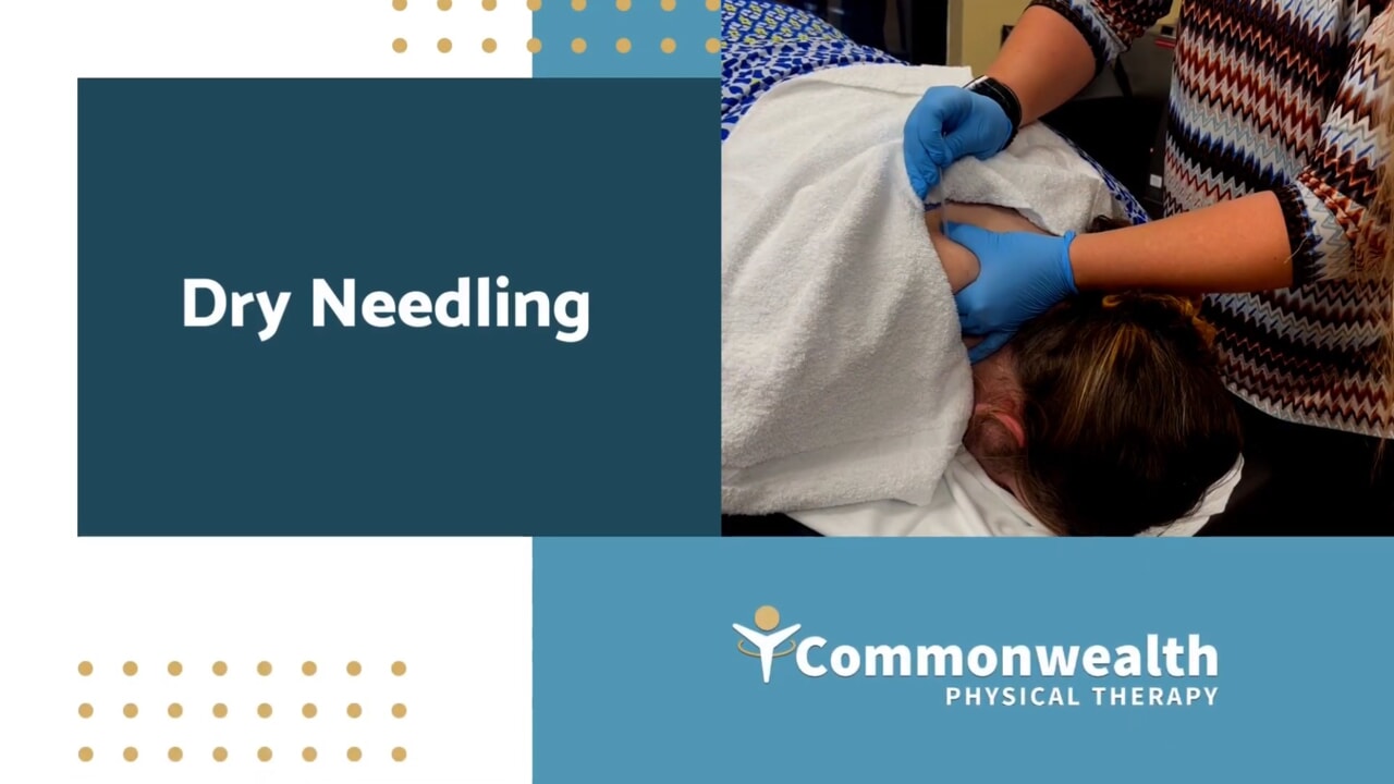 dry accupuncture needling